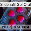 Sildenafil Gel Oral 13